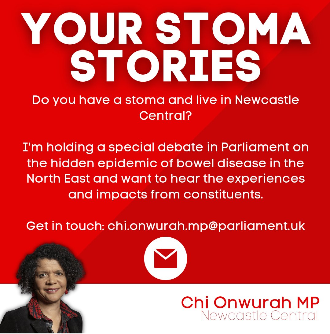 If you live in Newcastle Central I want to hear your Stoma Story